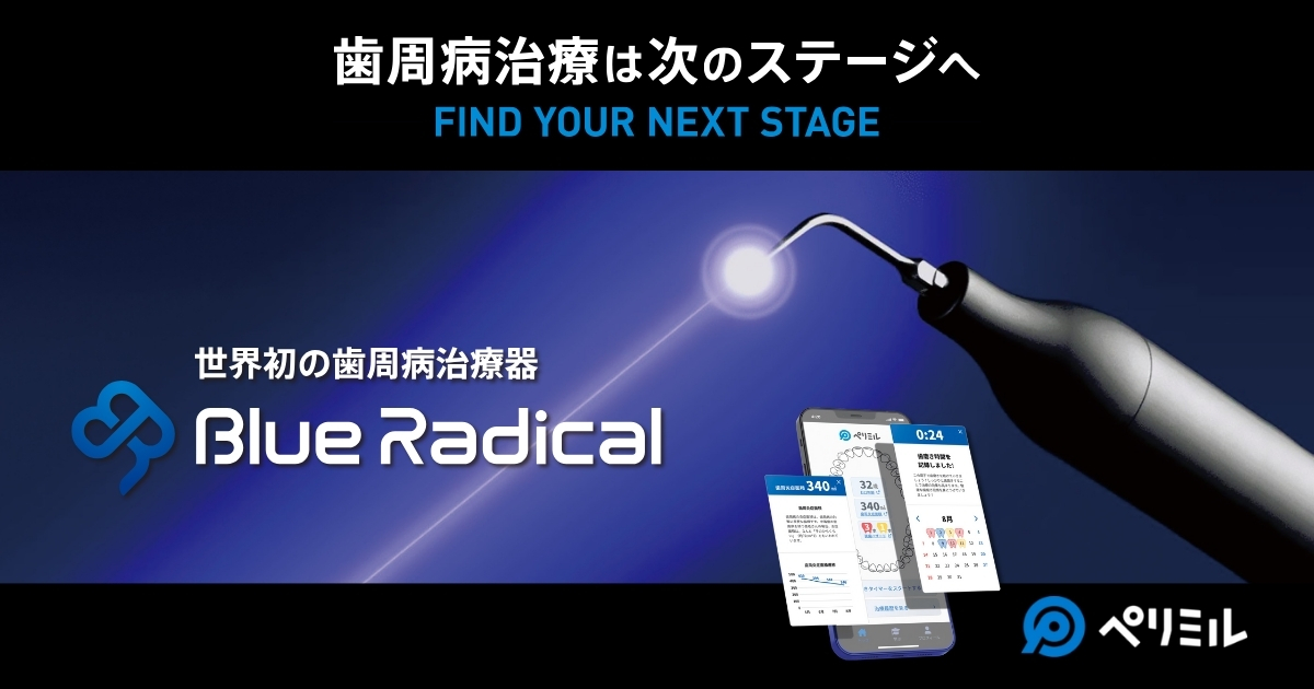 歯が抜けた時の新しい治療法コンフォート